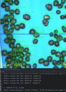 塑料粒子AI视觉高速检测解决方案